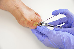 What to Do Before Using Topical Medications