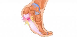 How to Stretch Properly?