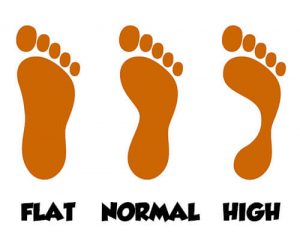 Foot Arch Types