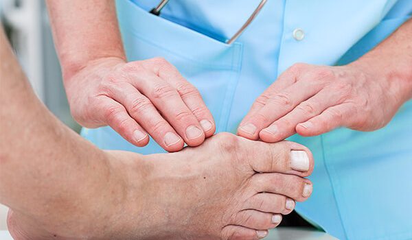 Lumps and Bumps on Side of Foot: Top Causes and Remedies