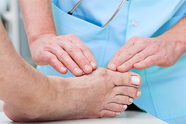 Lumps and Bumps on Side of Foot: Top Causes and Remedies
