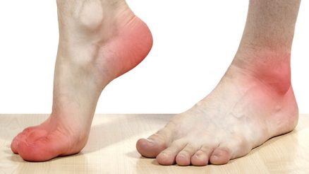 Pain on Outside of Foot: Learn About Its Causes, Diagnosis & Treatment