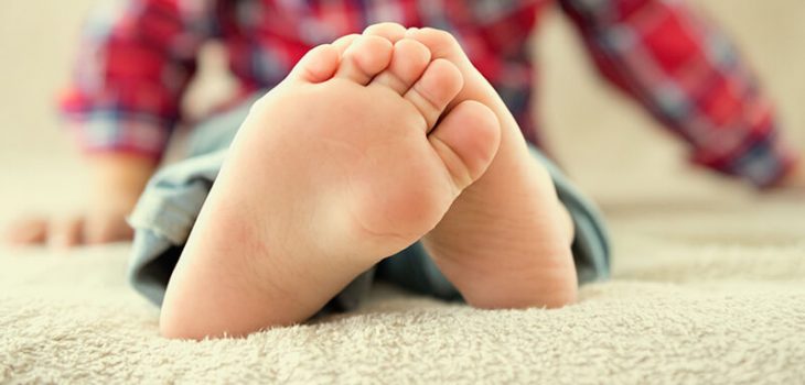 Flat Feet in Children