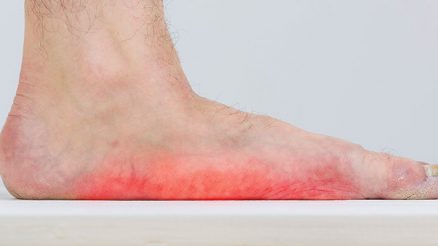 How to fix flat feet without surgery: 13 Treatments to Try