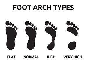 What are the Different Foot Arch Types