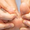 7 Home Remedies for Athlete’s Foot: Natural Relief at Home