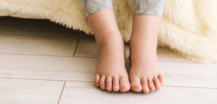 10 Home Remedies for Swollen Feet During Pregnancy