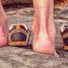 How to Avoid and Treat Blisters from Running