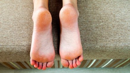 7 Natural Ways to Soften Hard Skin on Feet