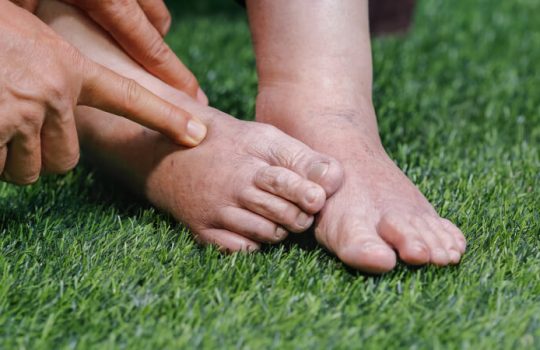 How to Reduce Swelling in Senior Feet