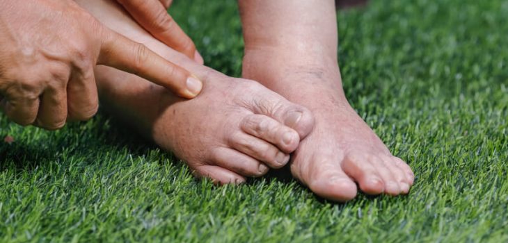 How to Reduce Swelling in Senior Feet