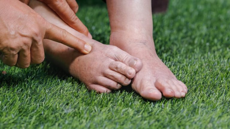 How to Reduce Swelling in Senior Feet