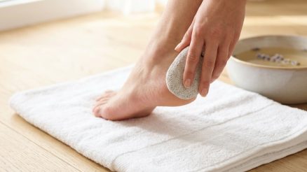 How to Get Rid of Corns and Calluses: The Complete Removal Guide